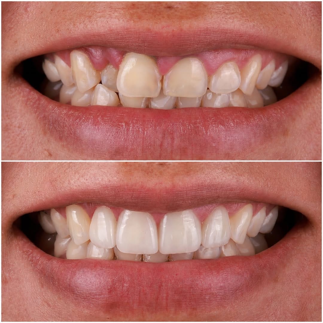 Post 1 by Sean Kutlay DDS on Instagram (image)