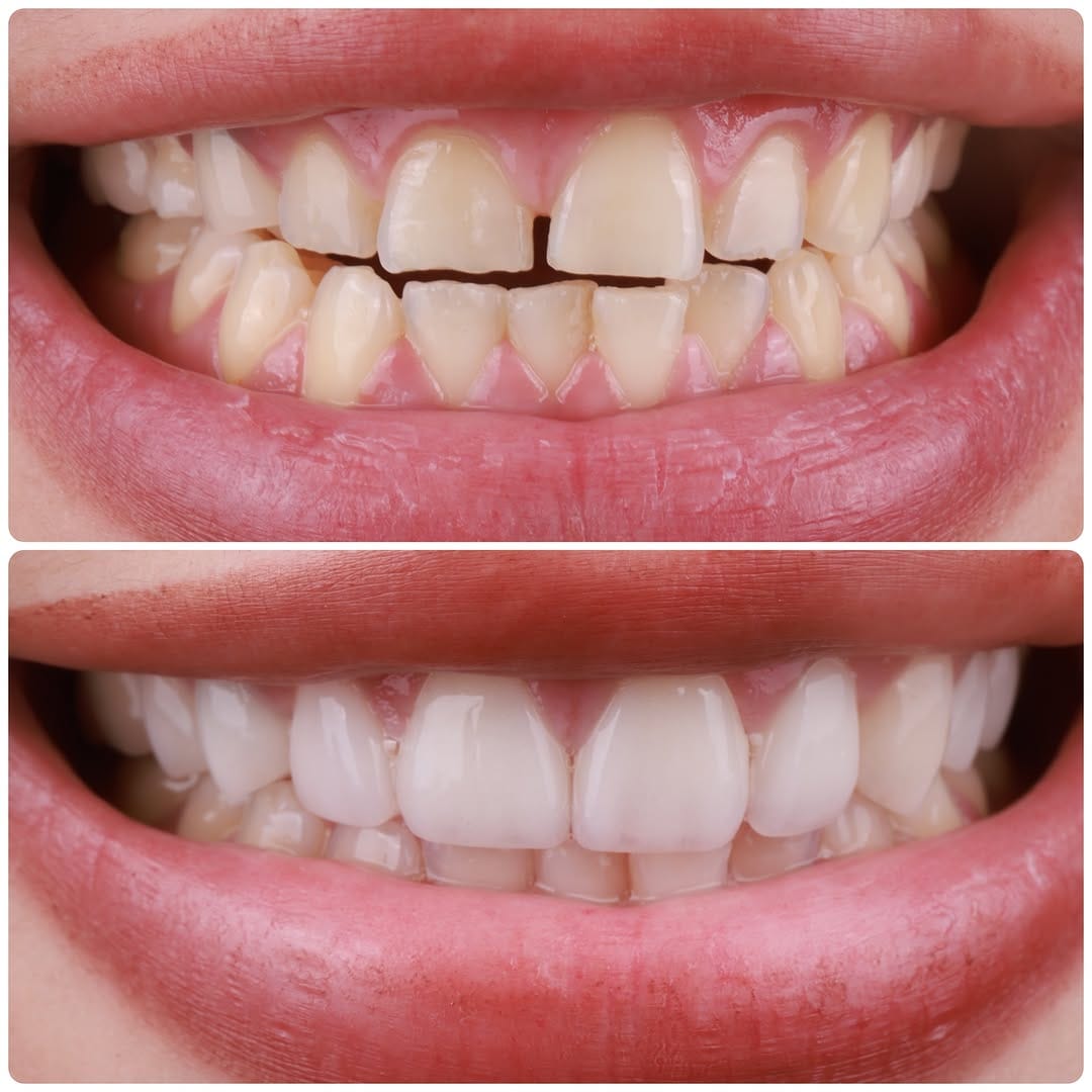 Post 4 by Sean Kutlay DDS on Instagram (carousel)