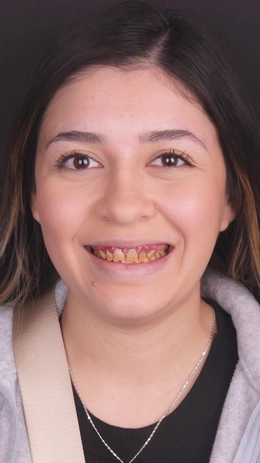 Post 10 by Sean Kutlay DDS on Instagram (video)