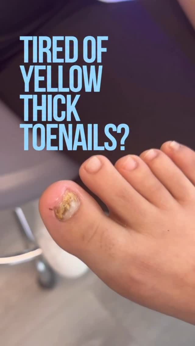 Post 10 by Dr. Jared Shipp • Podiatry on Instagram (video)