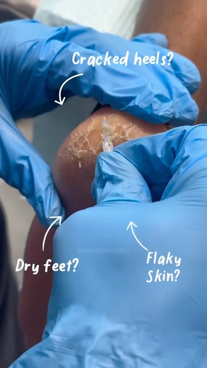 Post 6 by Dr. Jared Shipp • Podiatry on Instagram (video)
