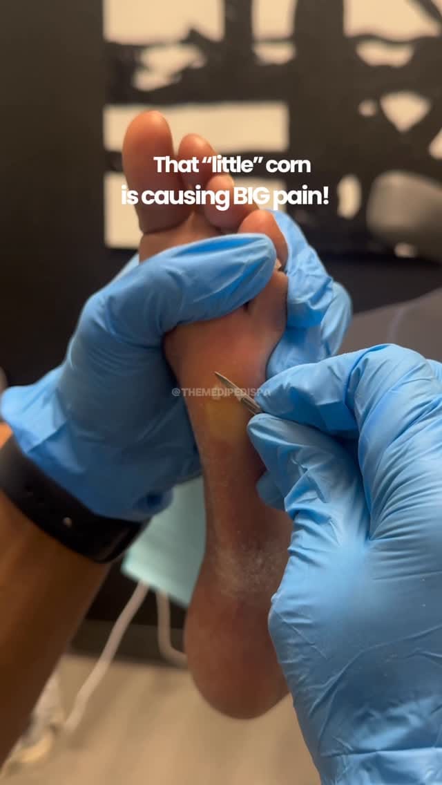 Post 7 by Dr. Jared Shipp • Podiatry on Instagram (video)