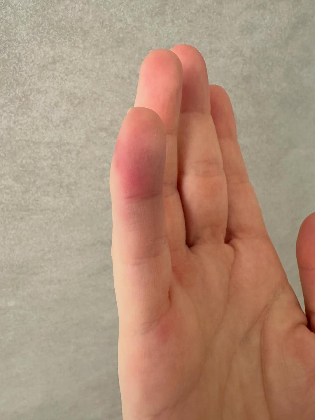 Post 1 by Aline Feltrin • Endocrinologista em João Pessoa on Instagram (carousel)