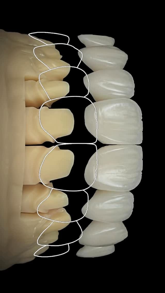 Post 6 by Baraa Al-Sayed | د.براء السيد | طبيب تجميل و زراعة الأسنان on Instagram (video)