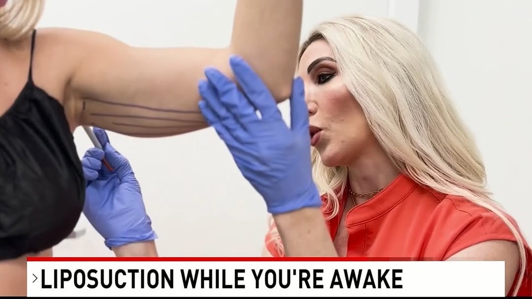 Post 10 by Kandace Kichler, MD, FACS on Instagram (video)