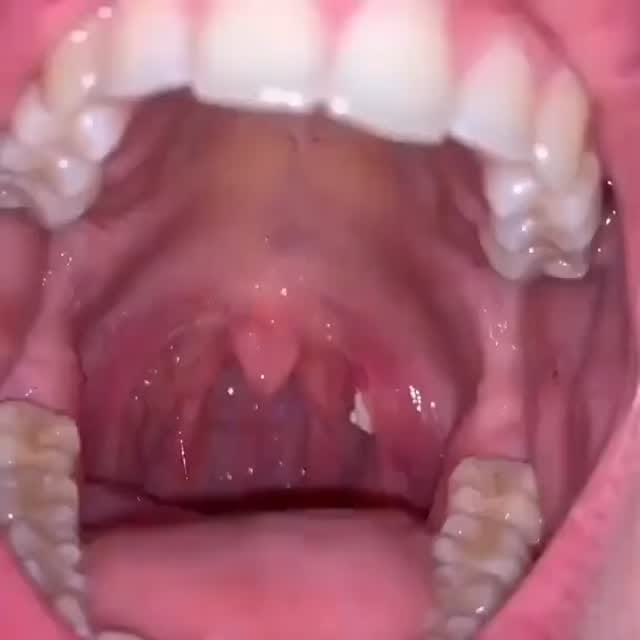 Post 2 by Medical Doctors on Instagram (video)
