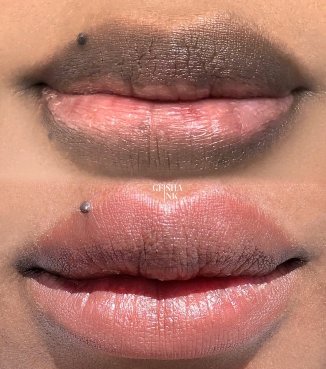 Post 10 by Cosmetic/Medical Tattooist on Instagram (image)
