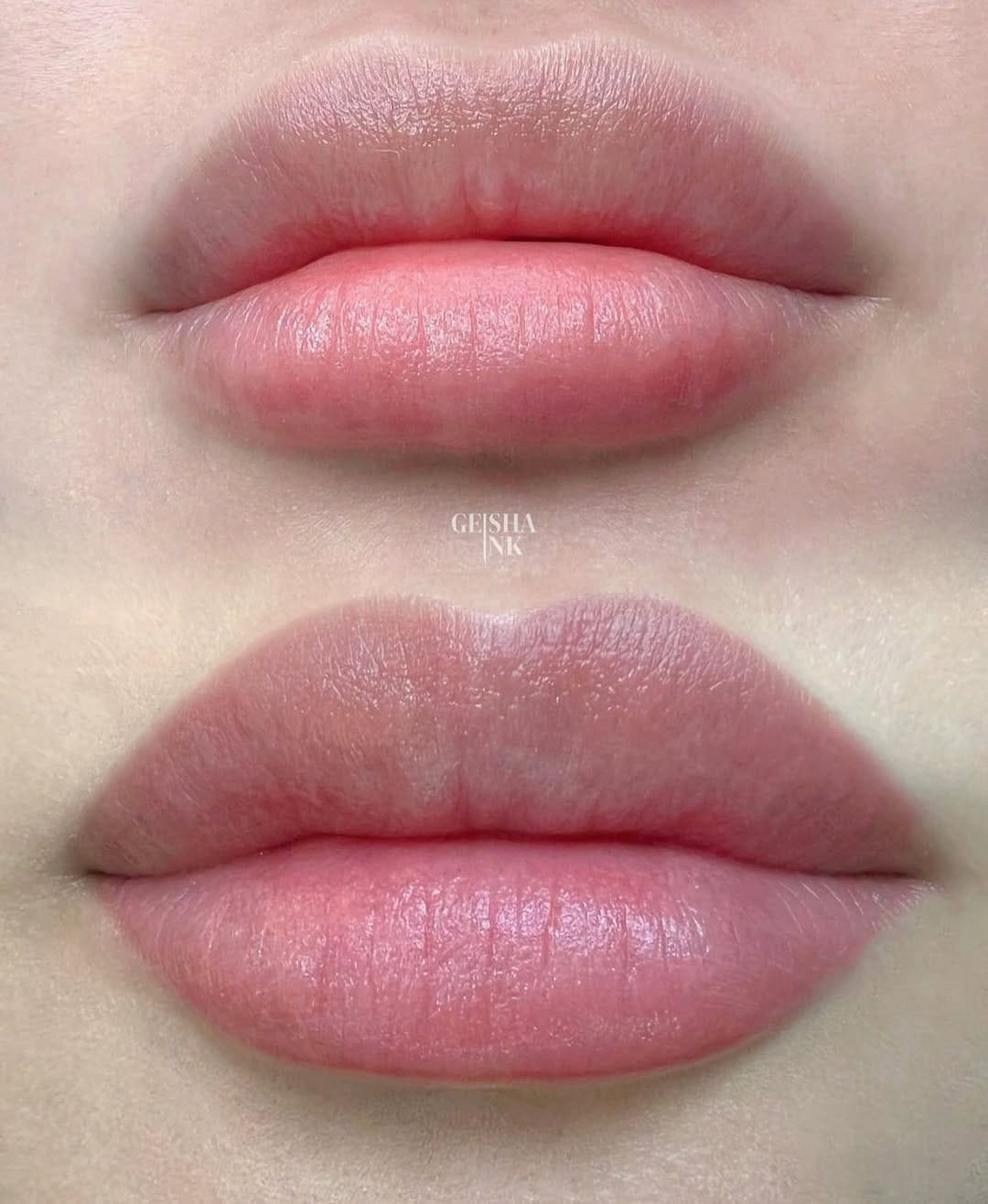 Post 9 by Cosmetic/Medical Tattooist on Instagram (image)