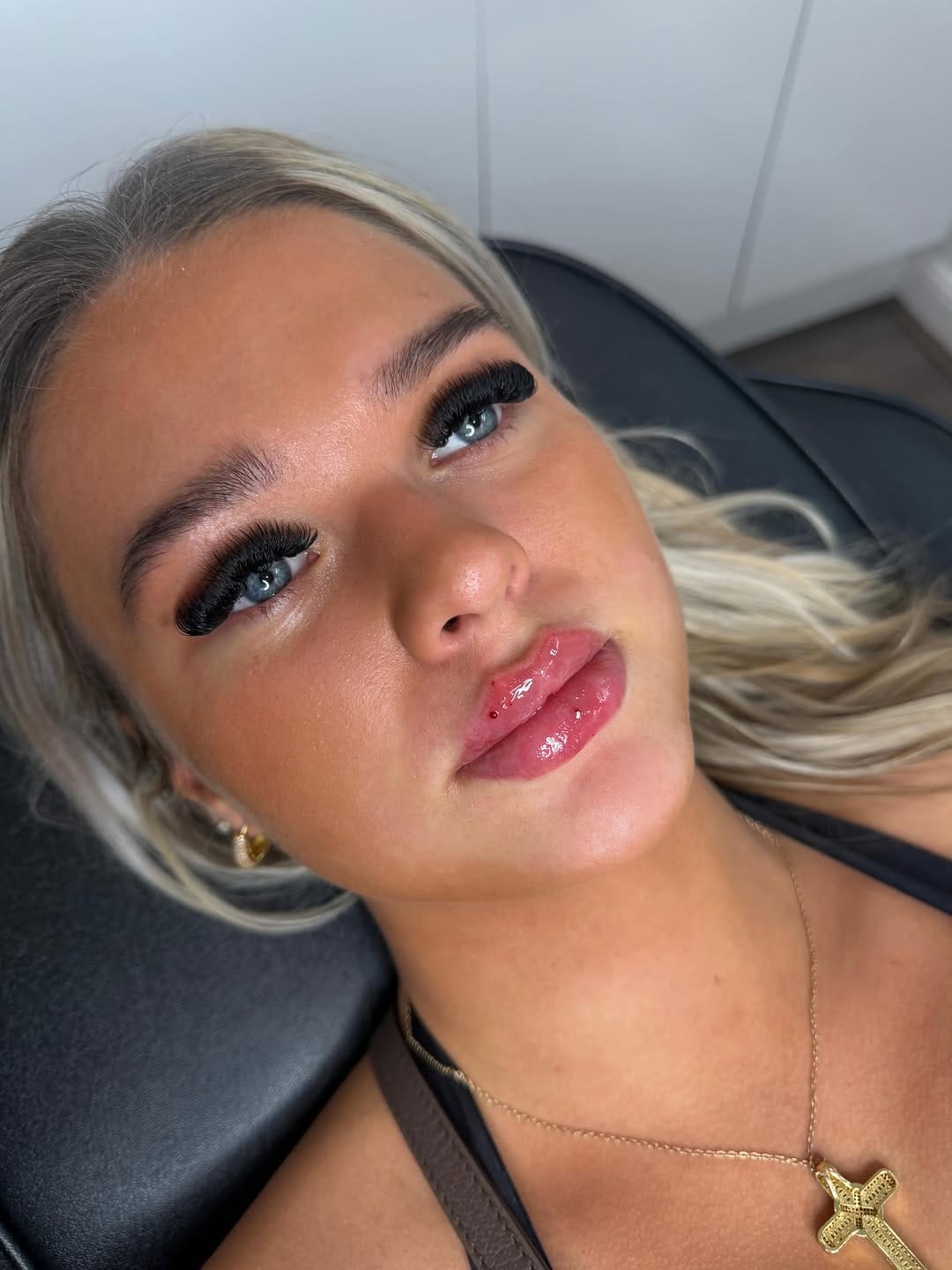 Post 3 by Aesthetics Birmingham on Instagram (image)
