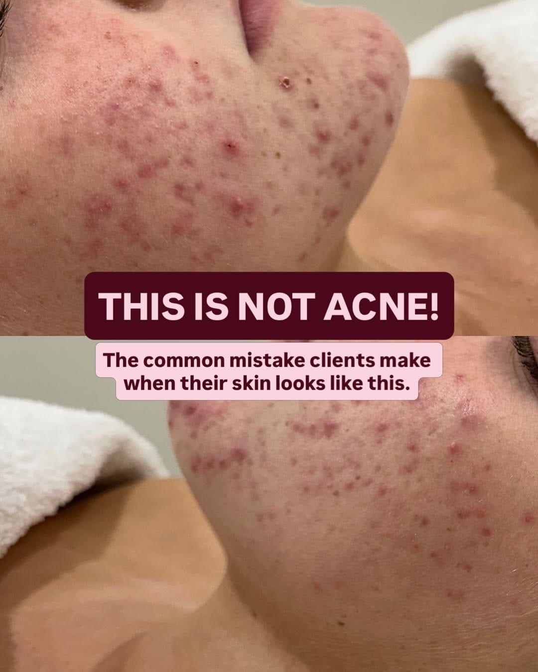 Post 1 by Skin Love | For your soul and confidence on Instagram (carousel)