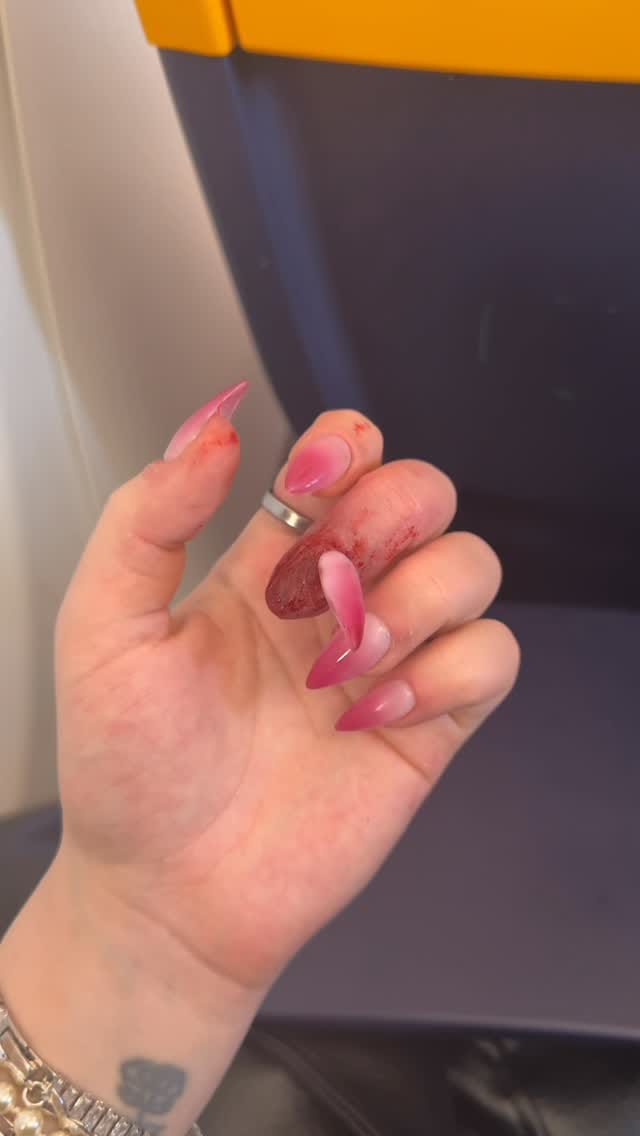 Post 9 by 𝐆𝐨𝐫𝐲 𝐜𝐨𝐧𝐭𝐞𝐧𝐭 on Instagram (video)