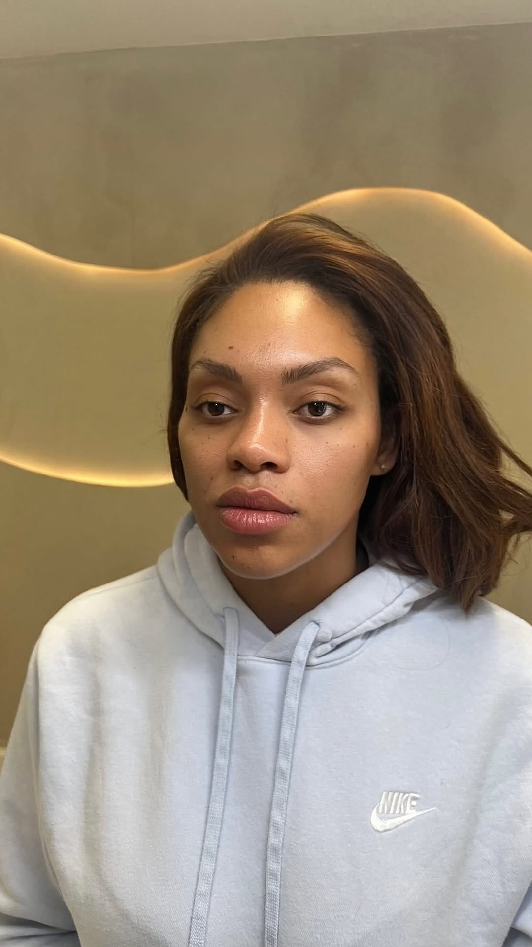 Post 4 by Atlanta Lip Fillers on Instagram (video)