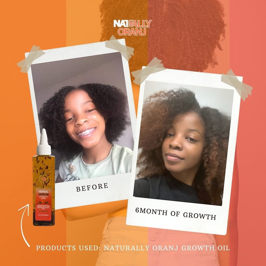 Post 5 by Natural Hair Care on Instagram (image)