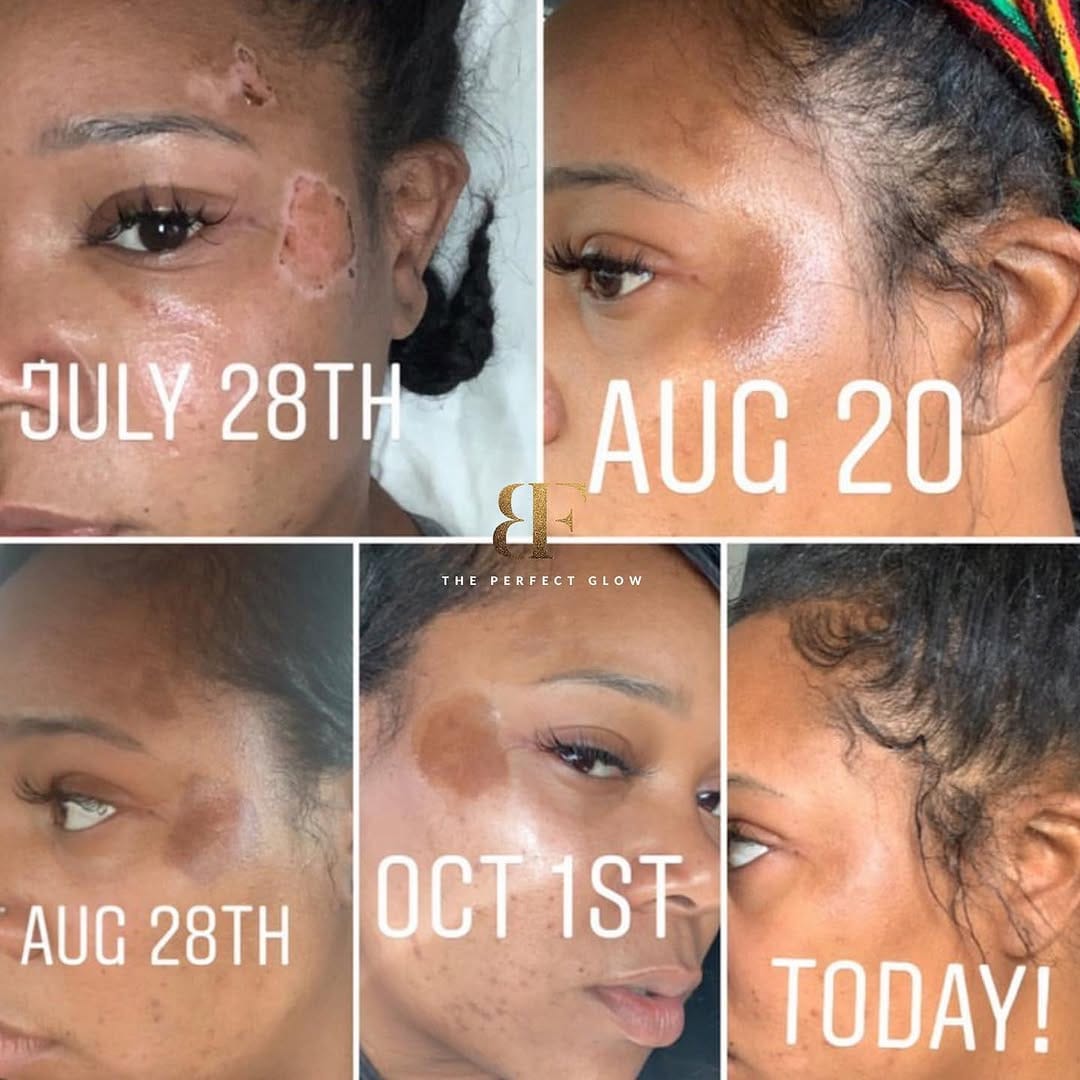 Post 10 by Get The Perfect Glow with B Faced on Instagram (carousel)