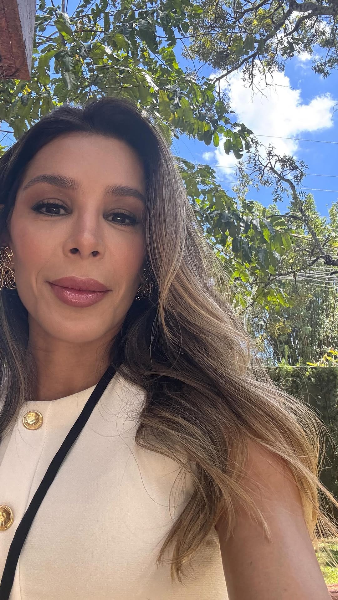 Post 4 by Simone Perini | Harmonização Facial • FULL FACE on Instagram (video)