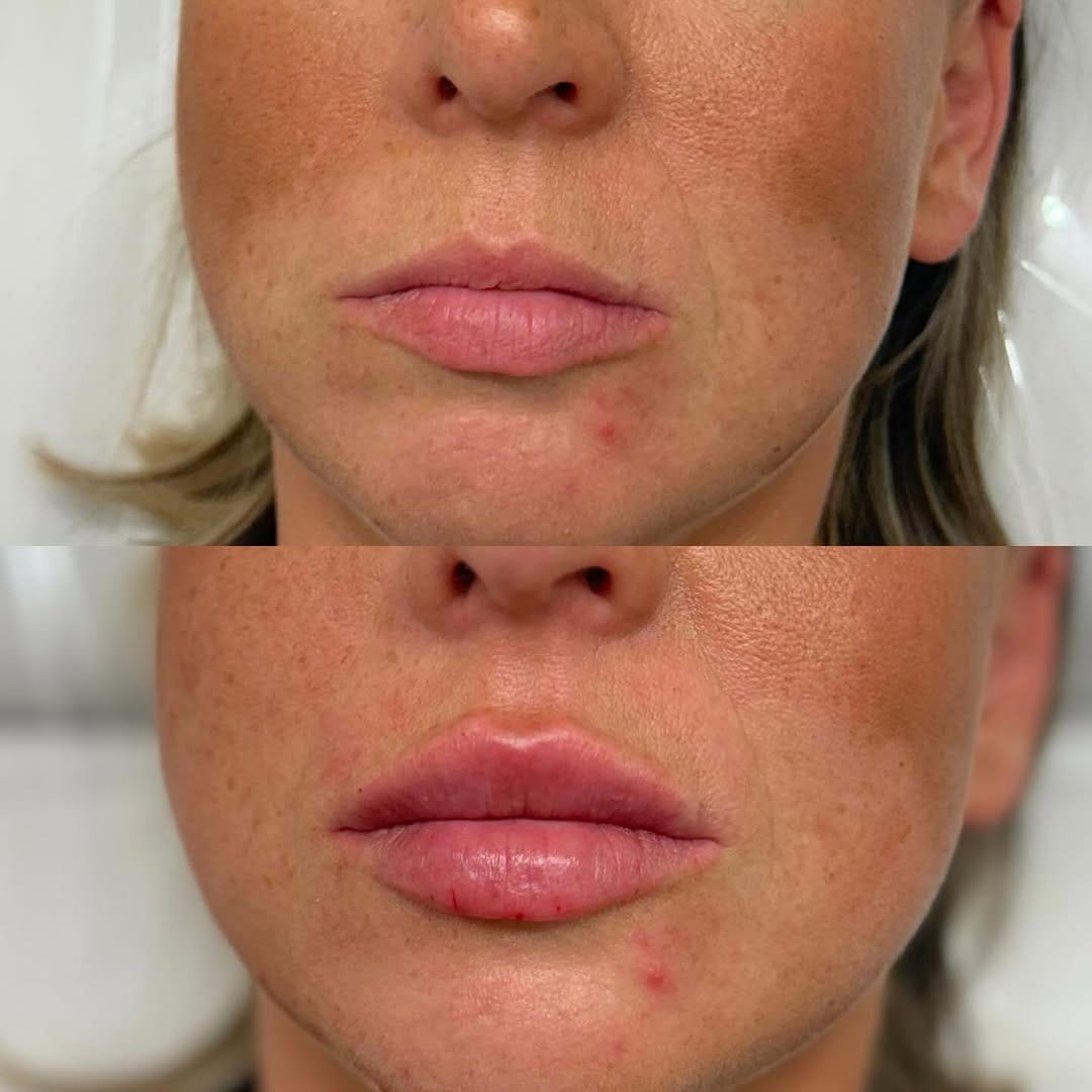 Post 7 by VIP AESTHETICS by Jessica Gibbs on Instagram (image)