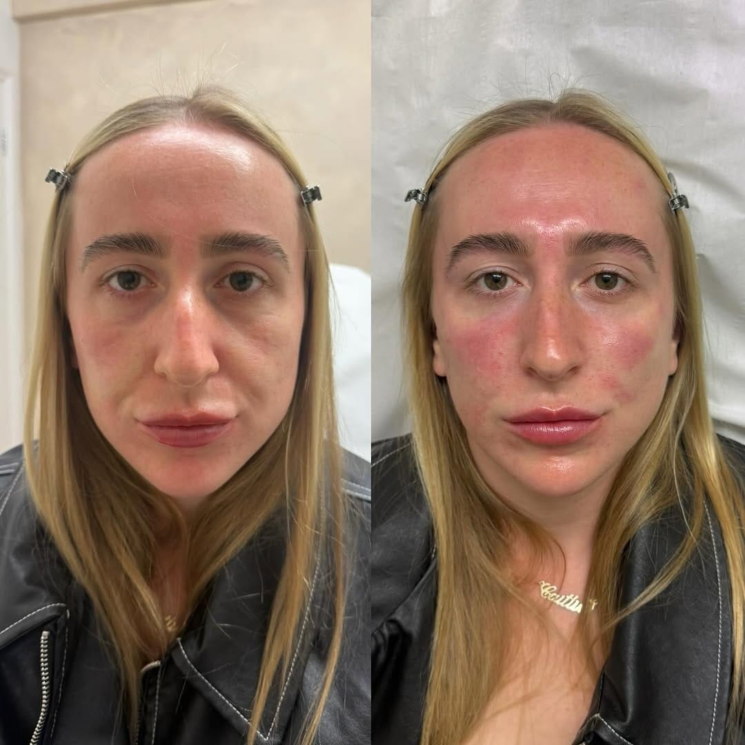 Post 6 by VIP AESTHETICS by Jessica Gibbs on Instagram (image)