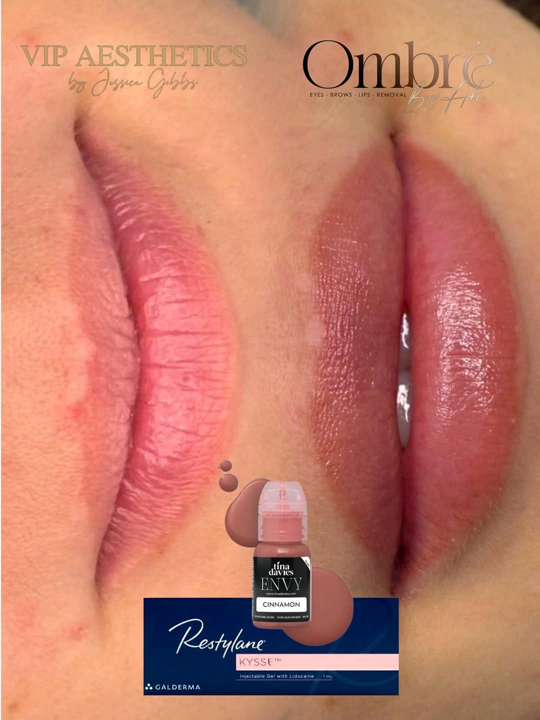 Post 9 by VIP AESTHETICS by Jessica Gibbs on Instagram (image)