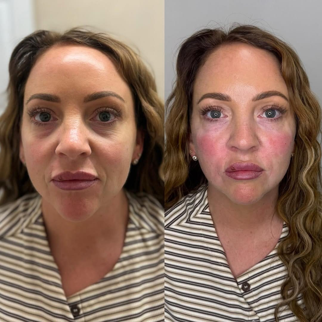 Post 2 by VIP AESTHETICS by Jessica Gibbs on Instagram (image)