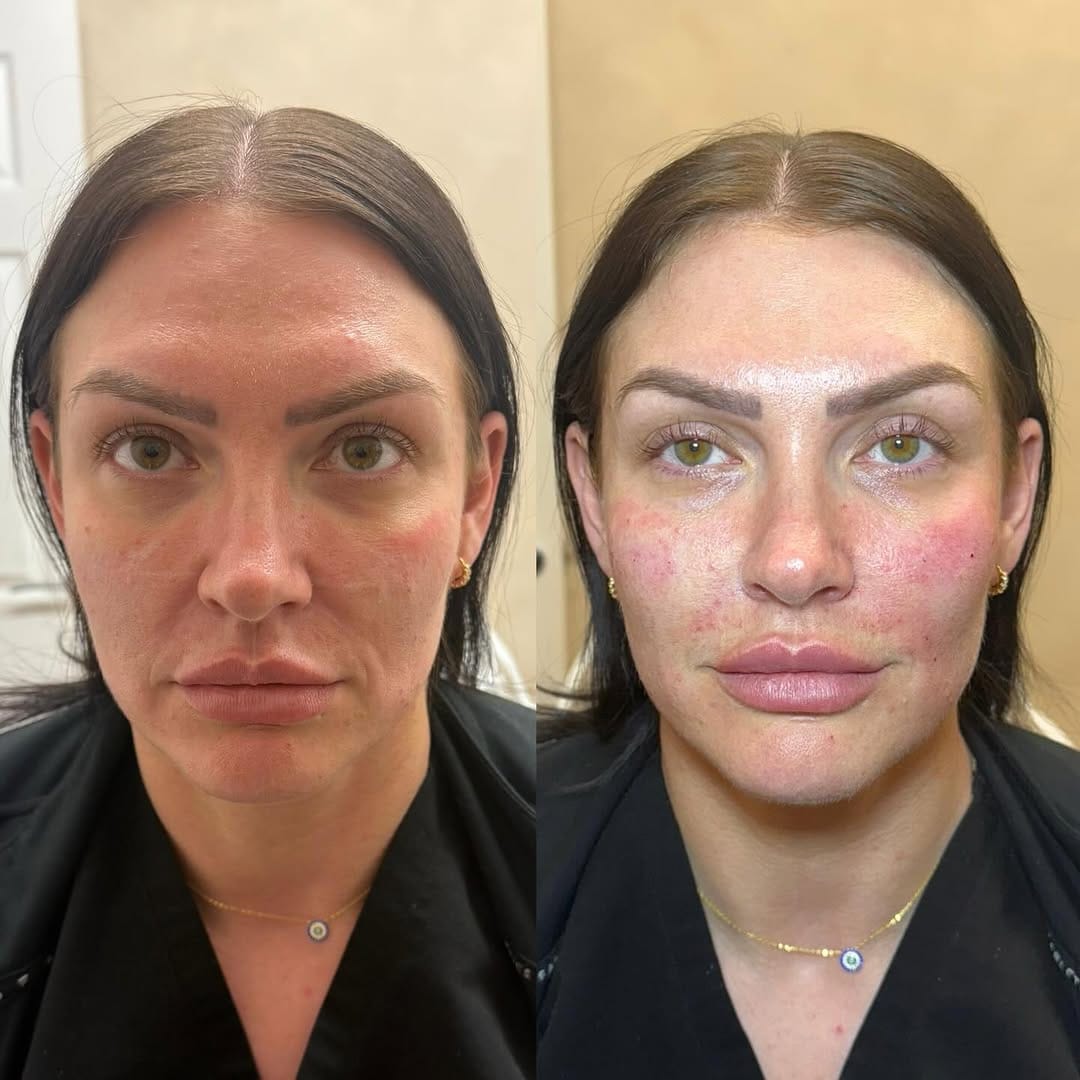 Post 4 by VIP AESTHETICS by Jessica Gibbs on Instagram (image)