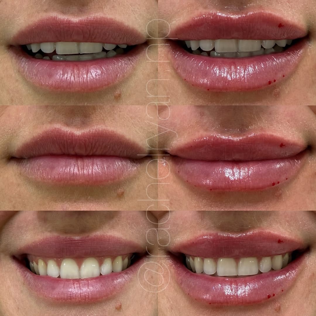 Post 2 by Rachel Ryan | FNP-C | MedSpa Boise on Instagram (image)