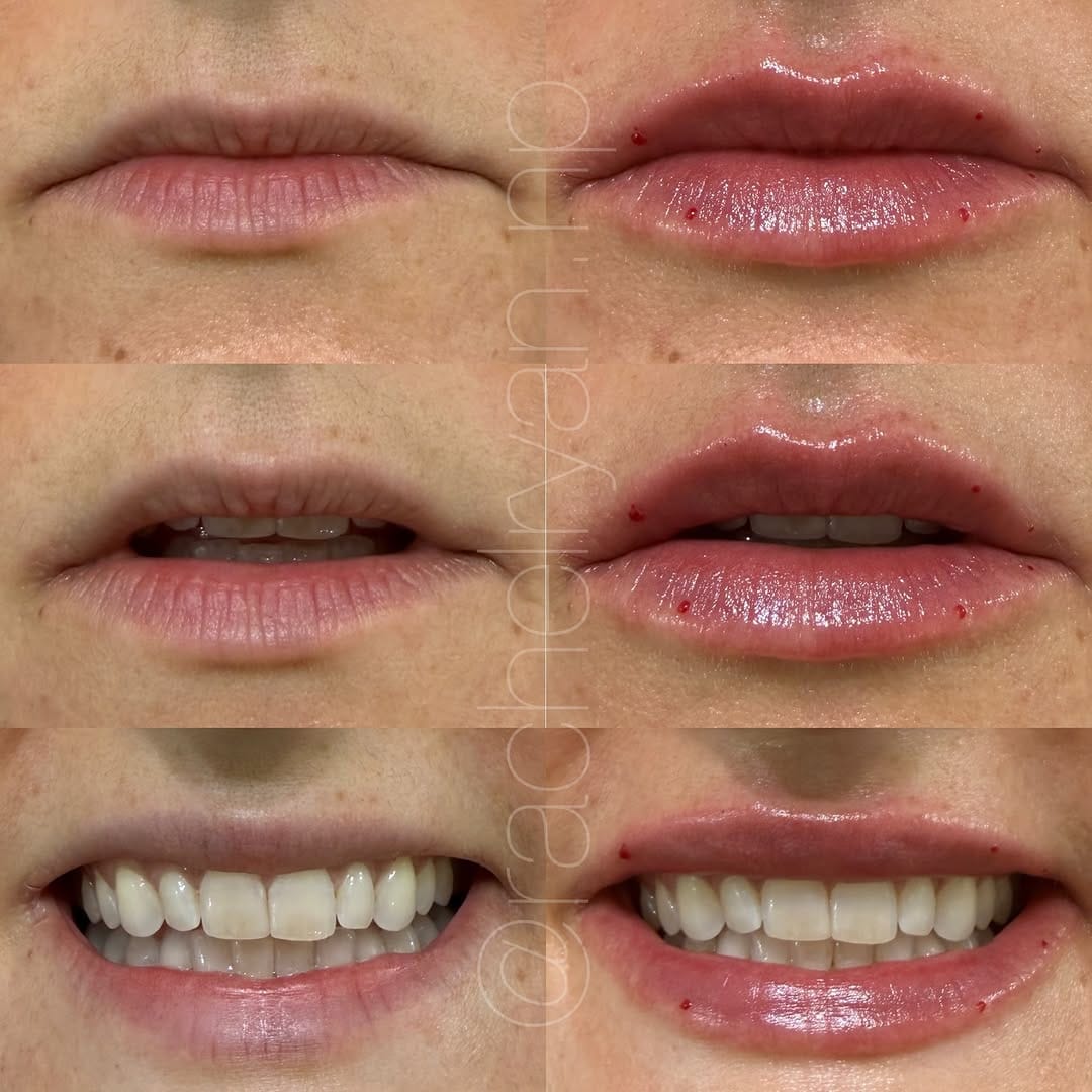 Post 7 by Rachel Ryan | FNP-C | MedSpa Boise on Instagram (image)