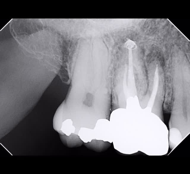 Post 2 by B. Craig Anderson, DMD on Instagram (video)