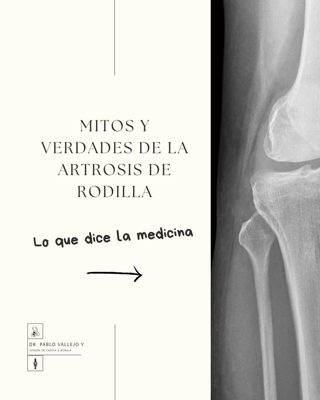 Post 5 by Dr. Pablo Vallejo Y on Instagram (carousel)