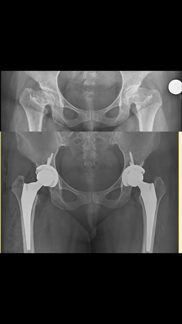 Post 7 by Dr. Pablo Vallejo Y on Instagram (video)