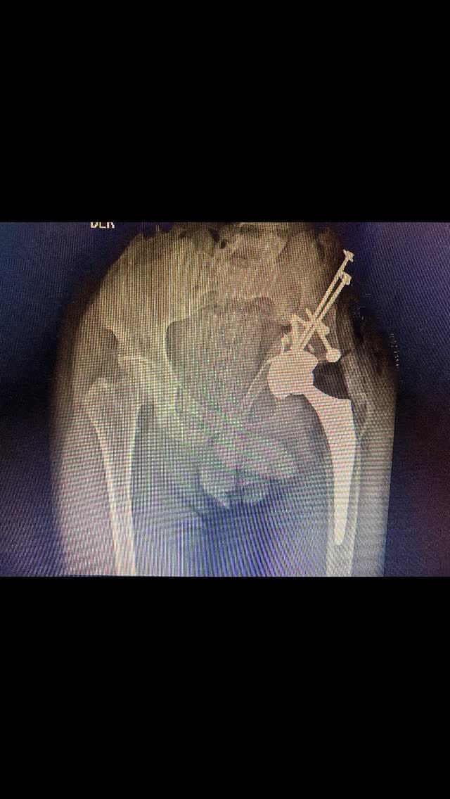Post 8 by Dr. Pablo Vallejo Y on Instagram (video)