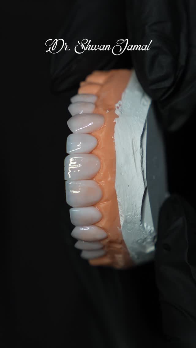 Post 2 by د. شوان  جمالDr.Shwan Jamal on Instagram (video)
