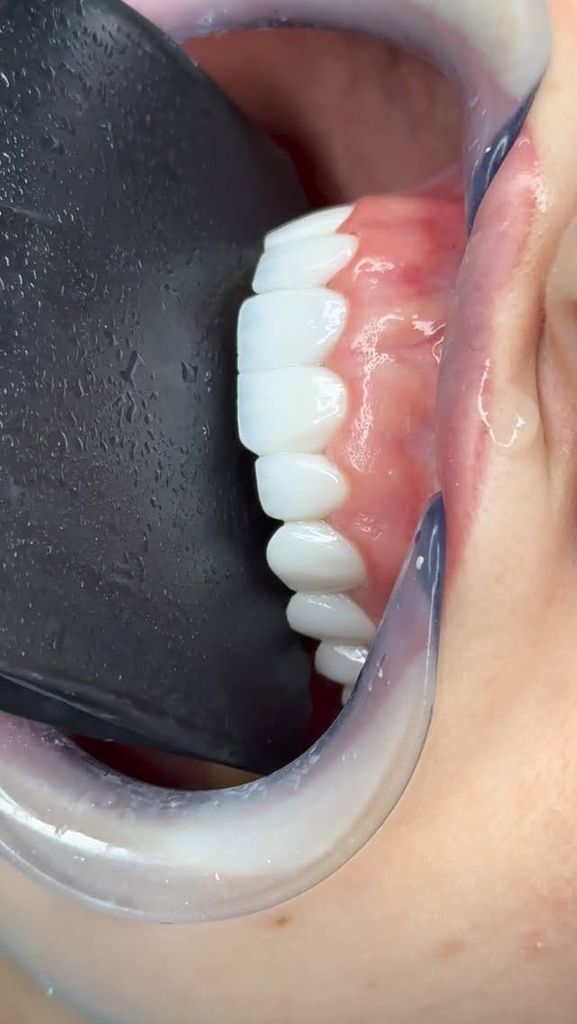 Post 6 by د. شوان  جمالDr.Shwan Jamal on Instagram (video)