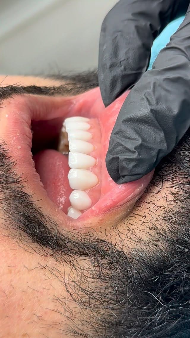 Post 8 by د. شوان  جمالDr.Shwan Jamal on Instagram (video)