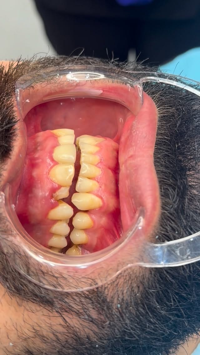 Post 5 by د. شوان  جمالDr.Shwan Jamal on Instagram (video)
