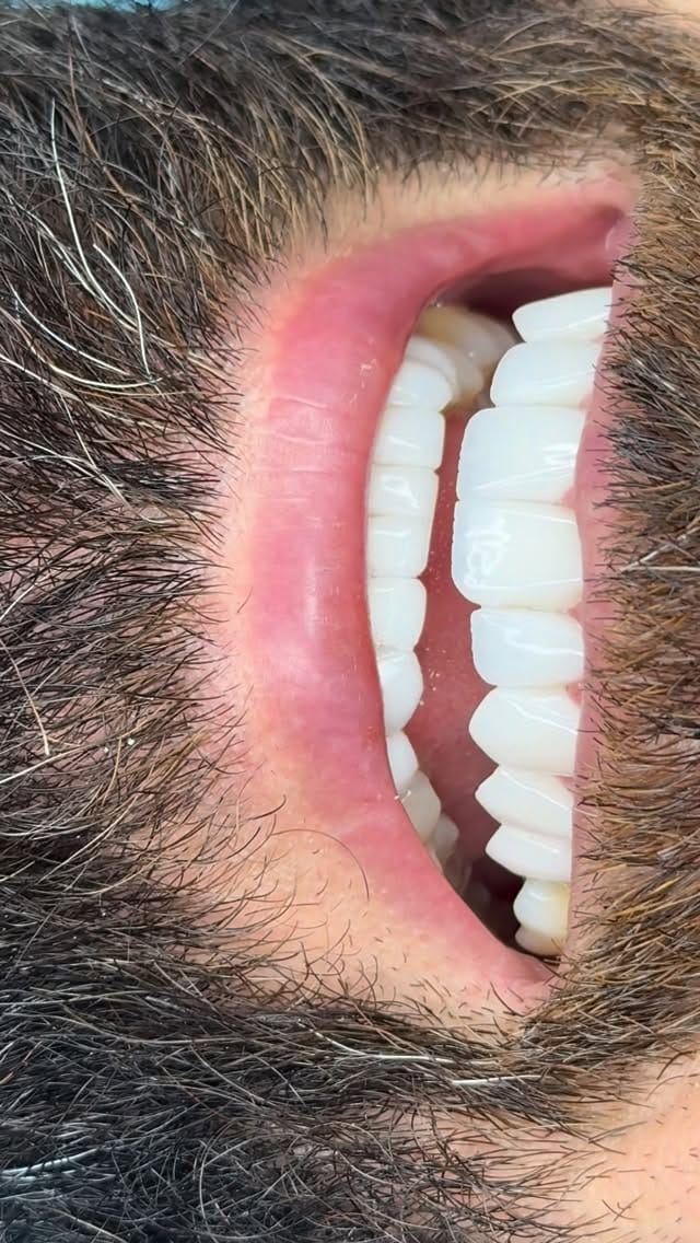 Post 7 by د. شوان  جمالDr.Shwan Jamal on Instagram (video)