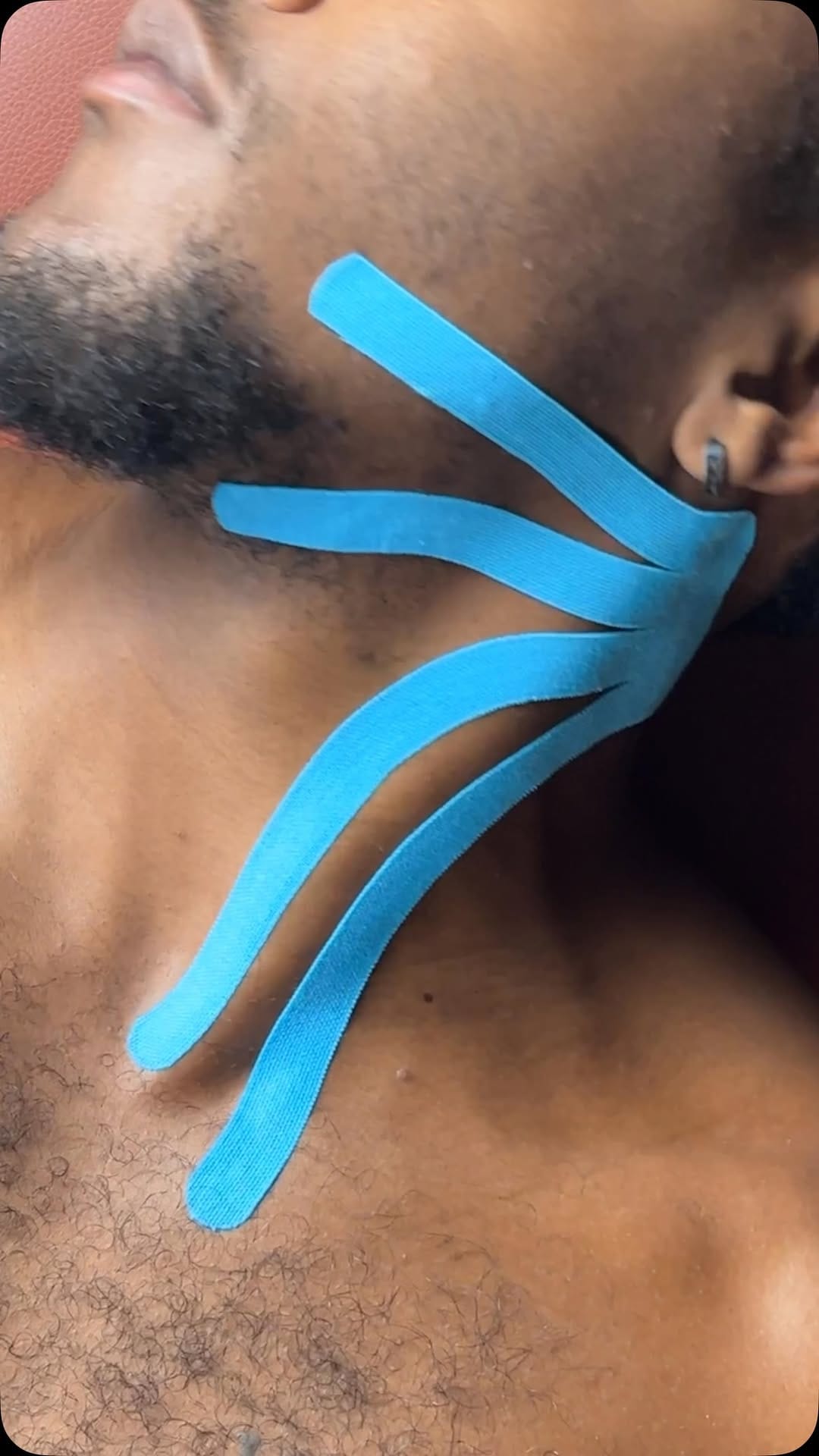 Post 2 by Spidertech Kinesiology Tape on Instagram (video)