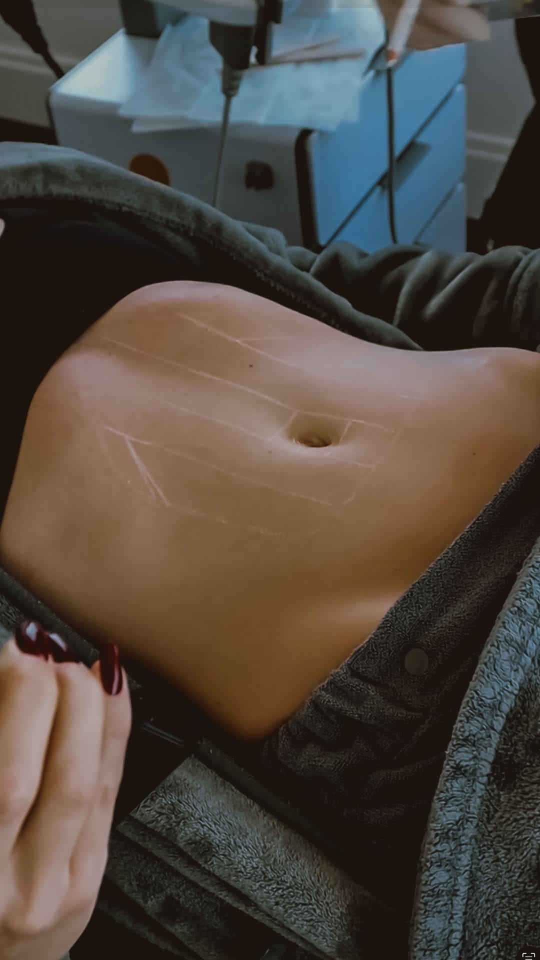 Post 9 by Dr. Shannon Humphrey on Instagram (video)