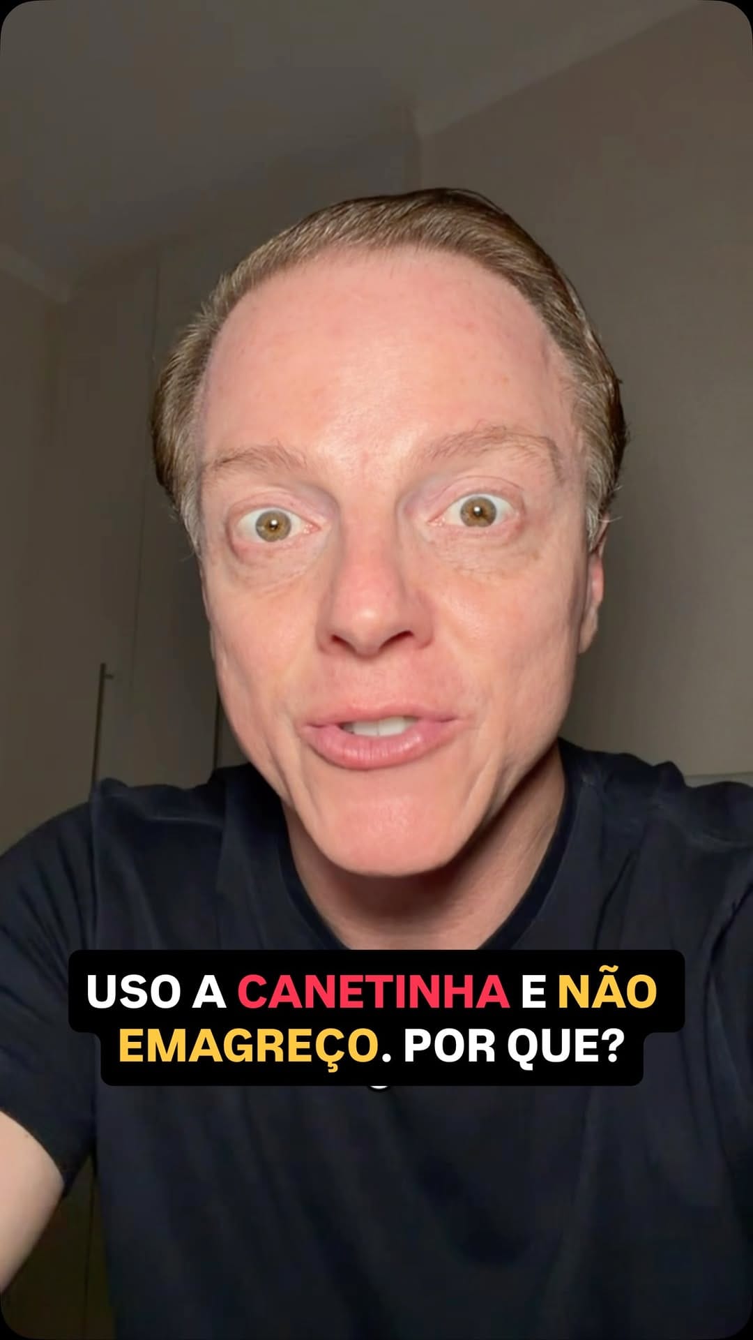 Post 9 by Dr. Marcos Galasso | CRM 135058 RQE 79196 on Instagram (video)