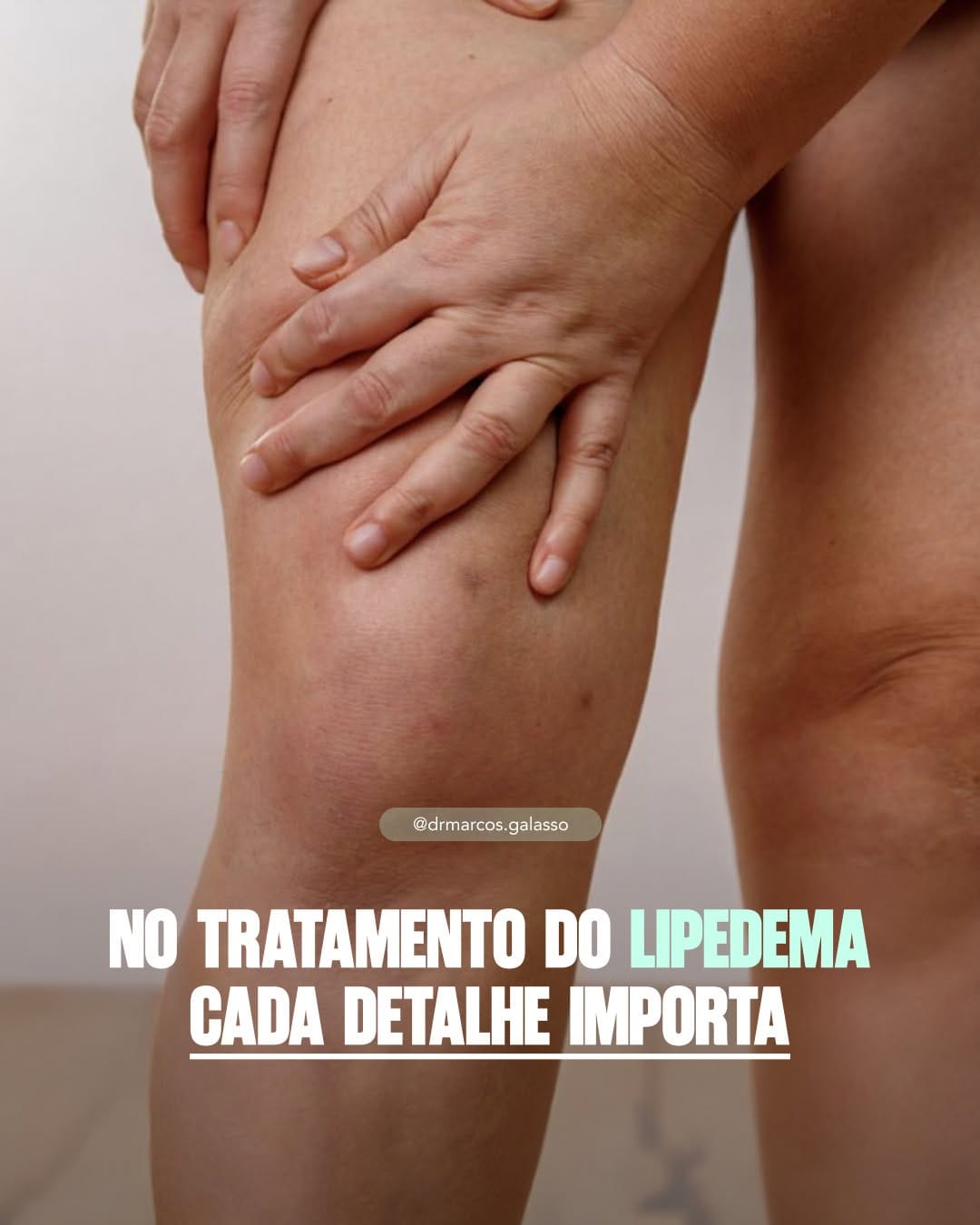 Post 5 by Dr. Marcos Galasso | CRM 135058 RQE 79196 on Instagram (carousel)
