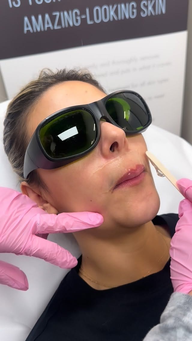 Post 4 by Nova Medispa on Instagram (video)