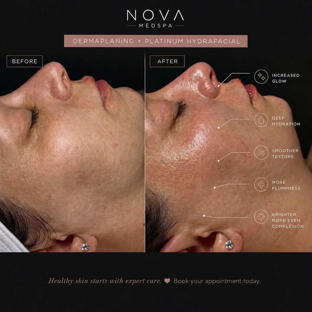 Post 5 by Nova Medispa on Instagram (image)