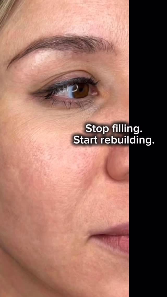 Post 3 by Heritage Way Medical Spa on Instagram (video)