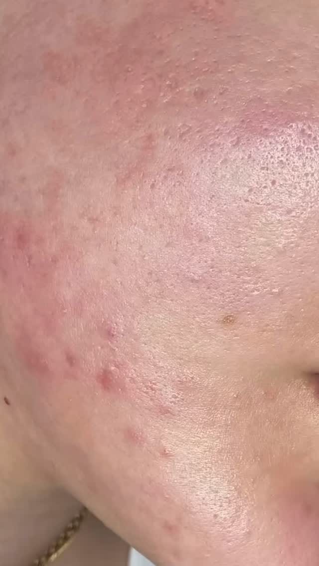 Post 10 by Heritage Way Medical Spa on Instagram (video)