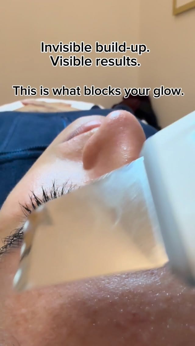 Post 7 by Heritage Way Medical Spa on Instagram (video)