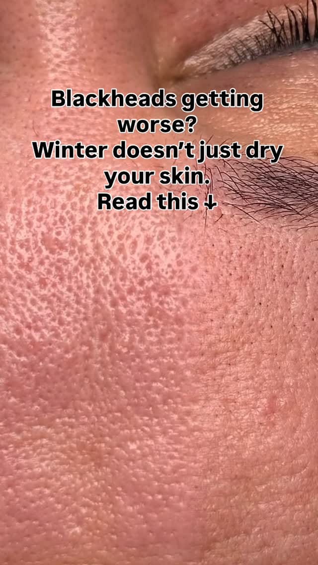 Post 5 by Heritage Way Medical Spa on Instagram (video)