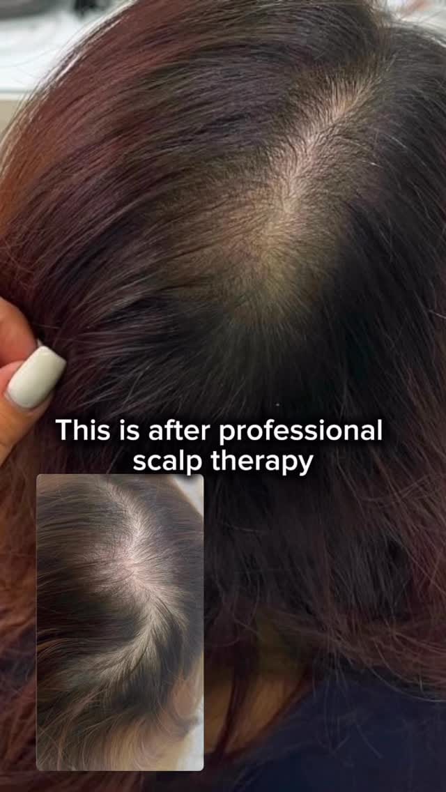 Post 1 by Heritage Way Medical Spa on Instagram (video)