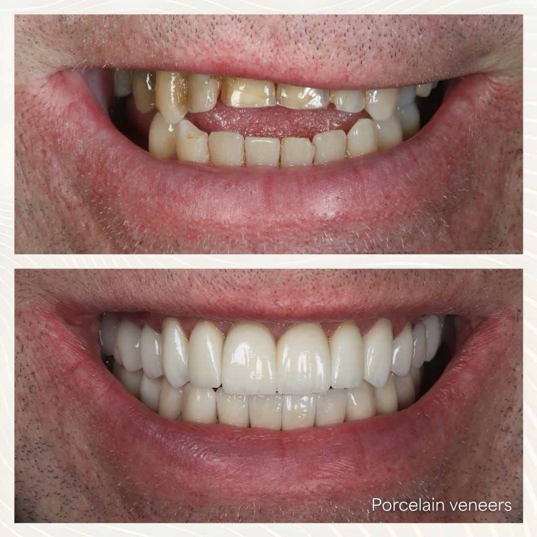 Post 3 by Dr Naveed Patel on Instagram (image)