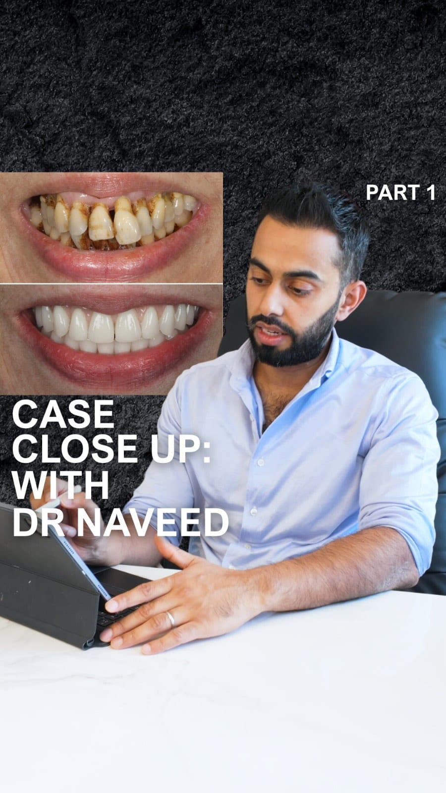 Post 10 by Dr Naveed Patel on Instagram (video)