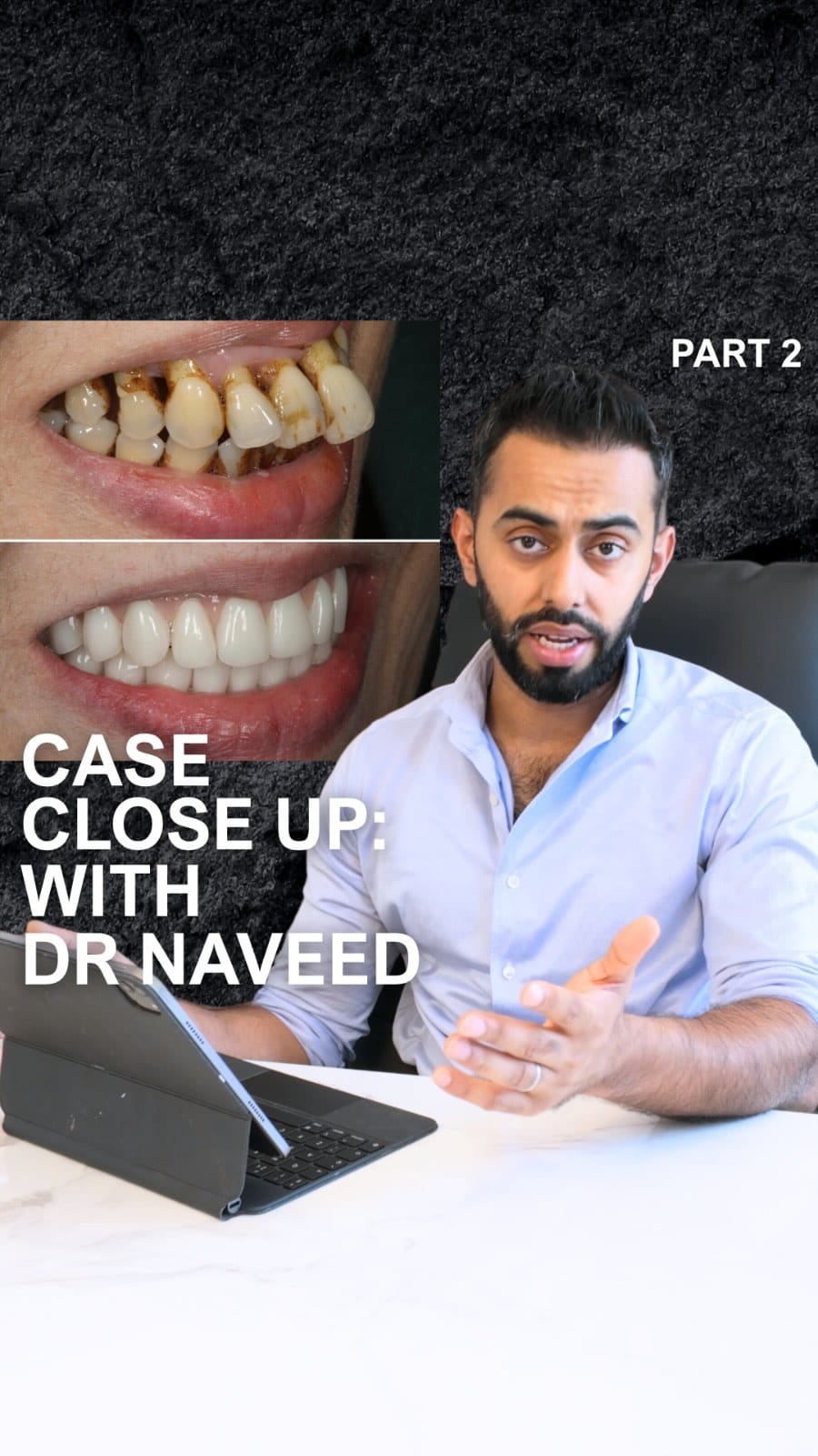 Post 9 by Dr Naveed Patel on Instagram (video)