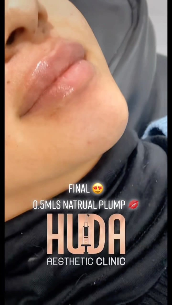 Post 6 by REBRANDED 👇🏻💉 PHANTOM MEDICAL GROUP on Instagram (video)